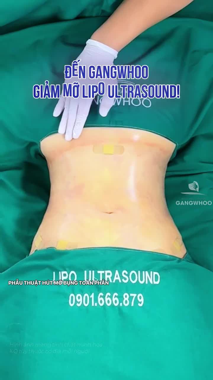 1 ngày "trốn chồng" đến Gangwhoo tân trang body, chị khách chia sẻ hài lòng sau làm giảm mỡ