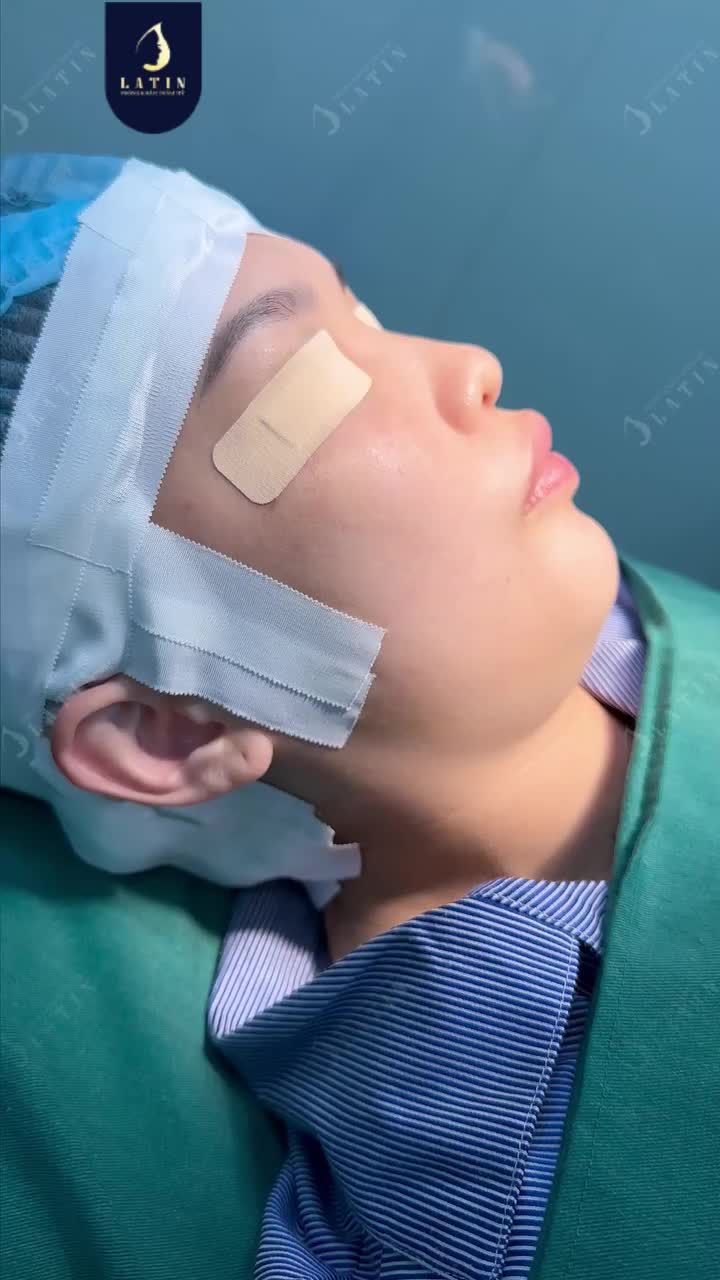 MỘT LẦN CẢI THIỆN, THẦN THÁI ĐỔI KHÁC