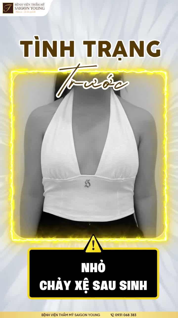 Vòng 1 đầy đặn cực trên, mềm mại như thật, kết quả đúng như những gì chị khách đã hình dung về vòng 1 trong mơ. Inbox Saigon Young nhận tư vấn cụ thể hơn.