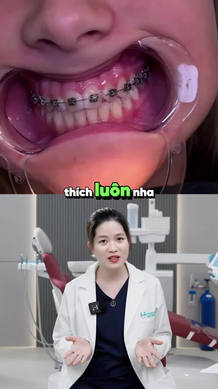 TRẺ EM BAO NHIÊU TUỔI NÊN NIỀNG RĂNG?