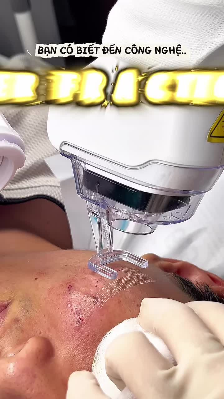 LỖ CHÂN LÔNG TO - DA SẦN - THÂM MỤN - SẸO RỔ..