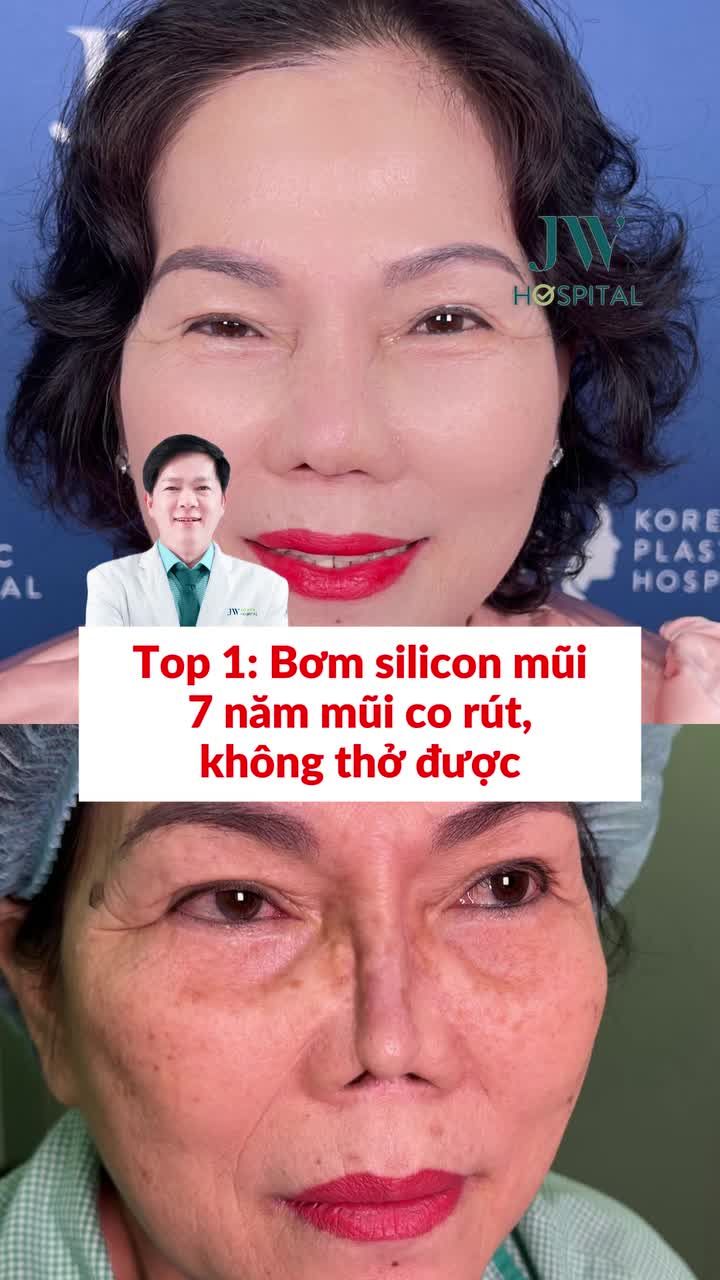 TỪ VIỆT NAM RA THẾ GIỚI: 4 CA MŨI CO RÚT ĐƯỢC BÁC SĨ TÚ DUNG MANG ĐẾN HỘI NGHỊ QUỐC TẾ APS CHÂU Á