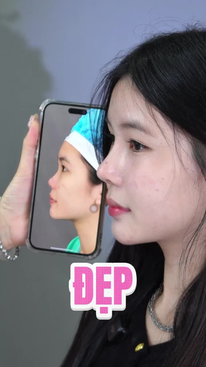 ĐẸP THANH TÚ NHỜ DÁNG MŨI CAO HÀI HÒA!!