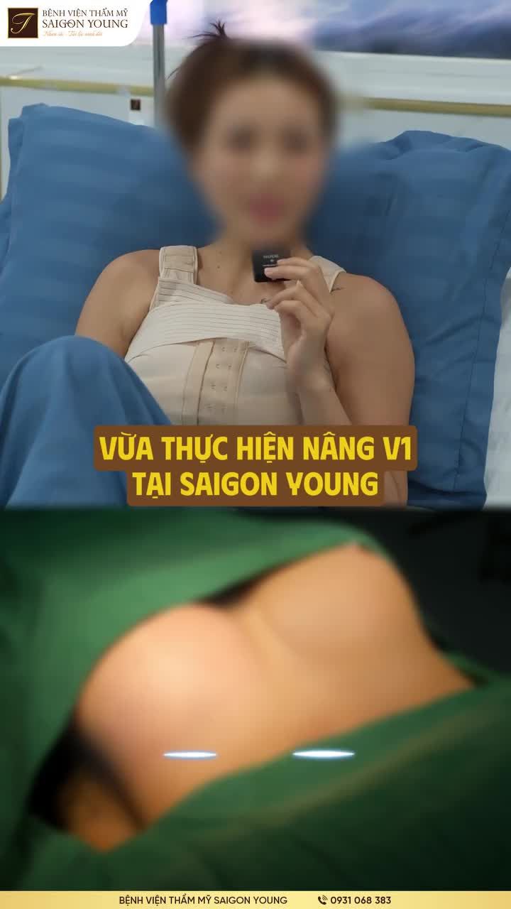 Nâng ngực nơi khác: Khe xa, tràn qua 2 bên