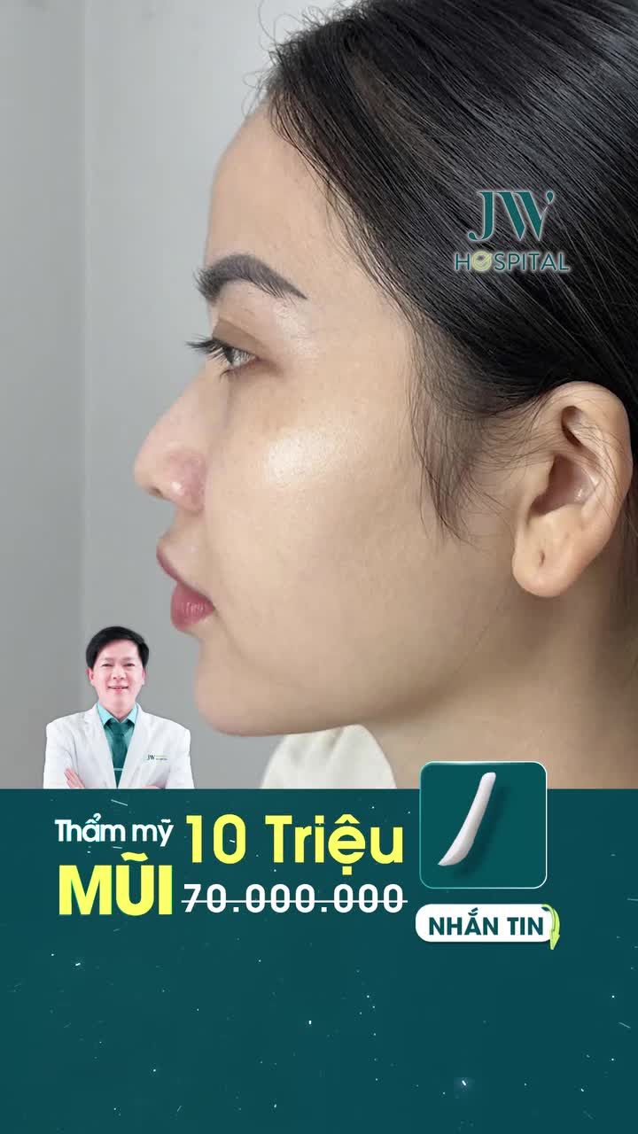 CHỊ GÁI 9X MIỀN TÂY HOÁ PHÚ BÀ SANG CHẢNH CHỈ SAU 1 LẦN NÂNG MŨI S LINE 3D TẠI JW