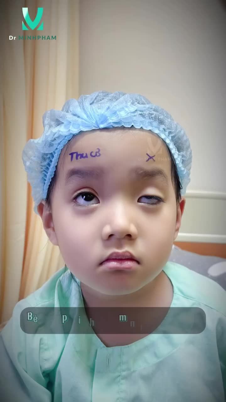 Ekip Dr. Minh Phạm hoàn thành xuất sắc công cuộc “tìm kiếm đôi mắt đẹp” cho bé Bảo An