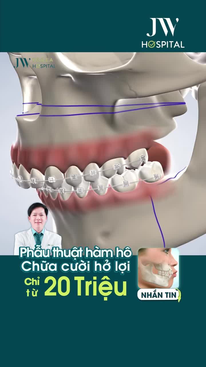 ĐỪNG C.Ắ.T HÀM HÔ NẾU CHƯA XEM QUY TRÌNH PHẪU THUẬT AN TOÀN CHUẨN Y KHOA TẠI JW
