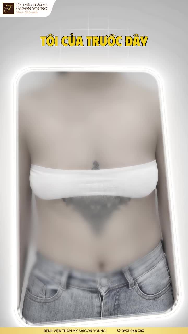 Vòng 1 mất dáng khiến niềm kiêu hãnh của chị B.N trong hôn nhân và cuộc sống cũng giảm đi.