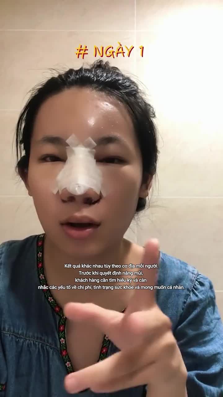 "Hụt hẫng" sau 4 ngày nâng mũi, kết quả của sinh viên 2K3 liệu có như ý? ĐỪNG BỎ LỠ những review chân thật của bạn ấy!!