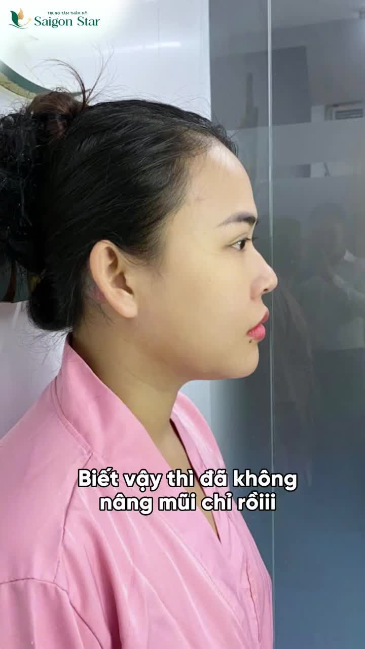 TRUNG BÌNH KHÁCH HÀNG NÂNG MŨI TẠI SAIGON STAR KIỂU: