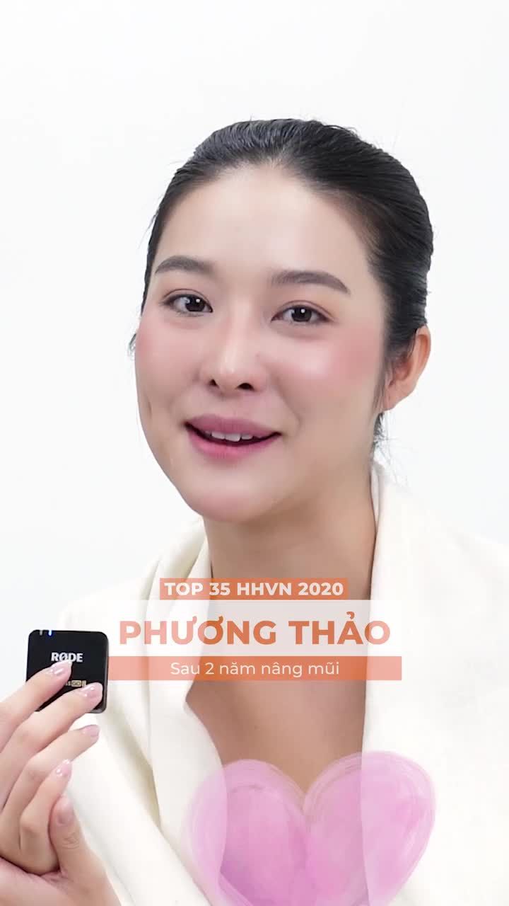 Vừa vào Đại học, sinh viên 2K7 được chị gái "thưởng" cho dáng mũi mới để tự tin và nổi bật hơn chỉ sau 4 tháng