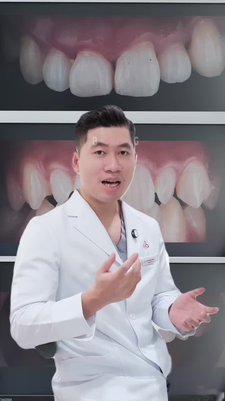 LÀM GÌ KHI RĂNG CỬA BỊ MẺ??