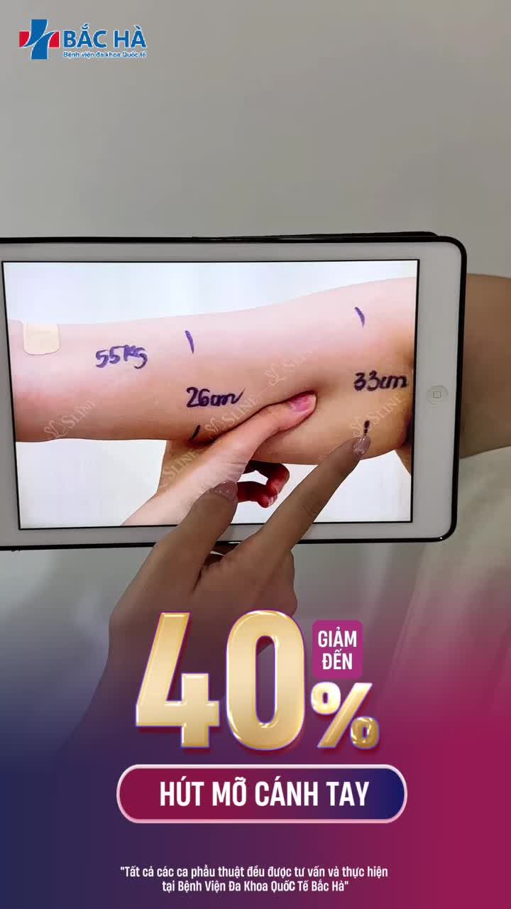 TAY KHÔNG BÉO… NHƯNG LÊN HÌNH LUÔN BỊ “TO”