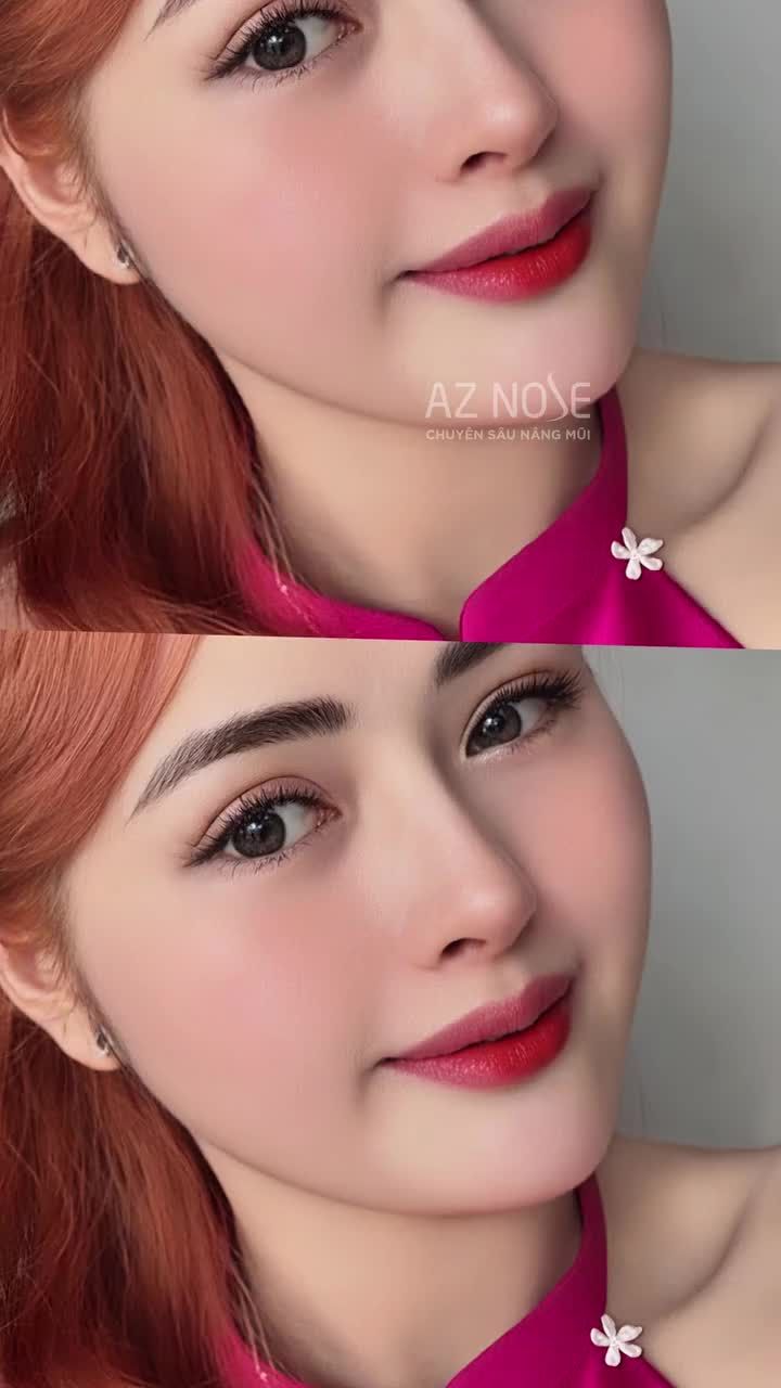 Góc nghiêng "sang xịn" hơn với dáng mũi mới