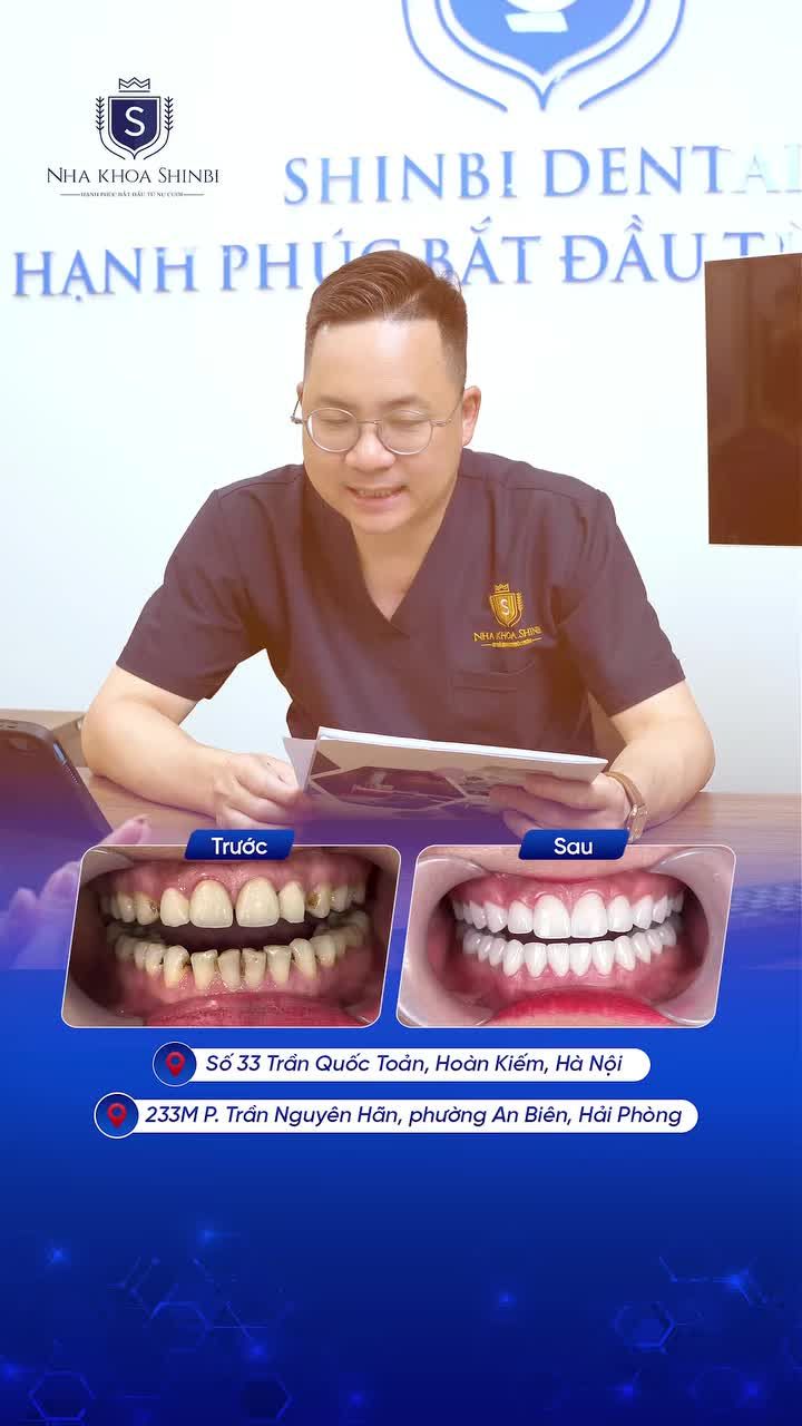VƯỢT HƠN 500KM TỪ QUẢNG BÌNH RA HÀ NỘI LÀM RĂNG – LIỆU CÓ ĐÁNG?