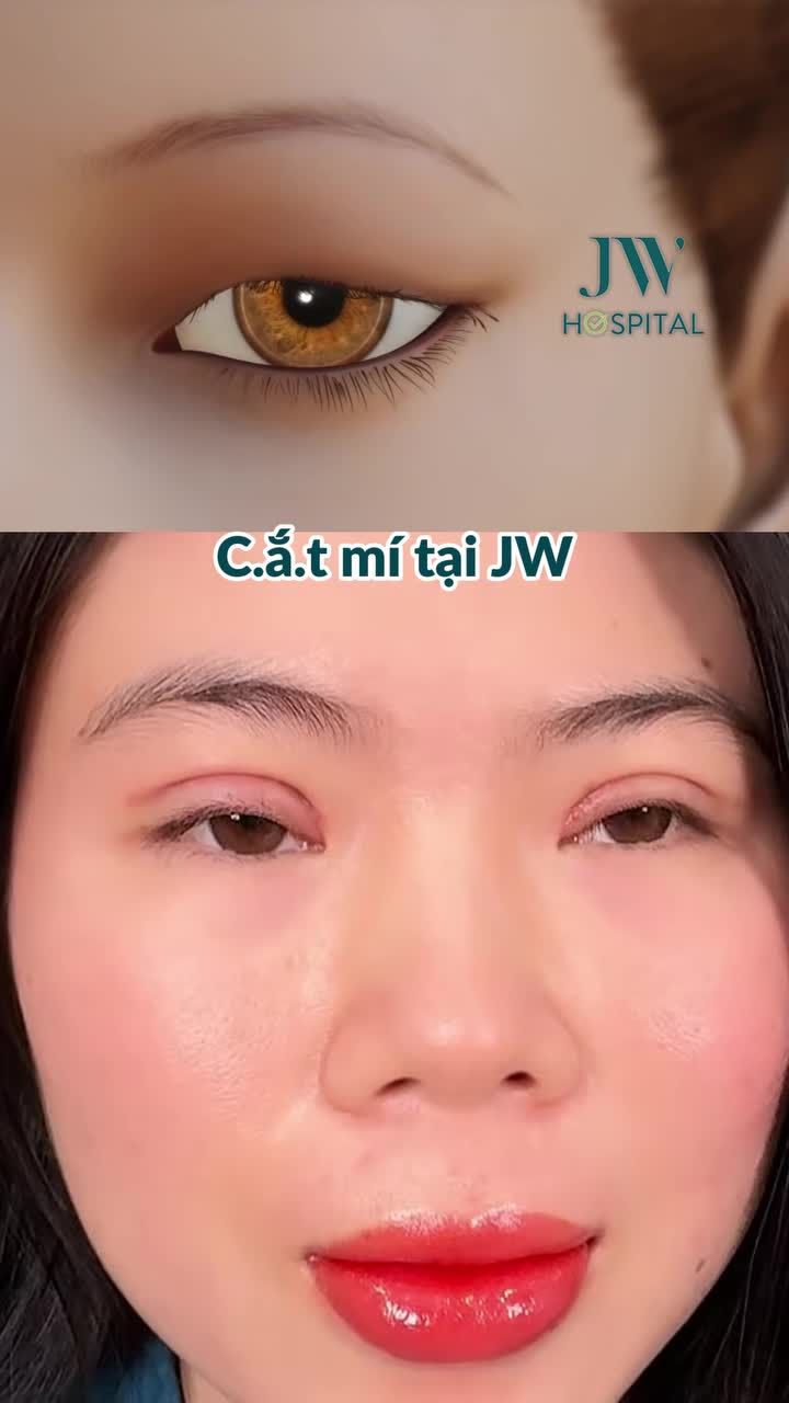 HÀNH TRÌNH 7 NGÀY XÓA MỘT MÍ HOÁ HOTGIRL CỦA CHỊ GÁI 9X SAU CẮT MẮT TẠI JW