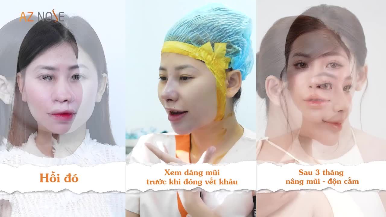 Combo mũi - cằm giúp Makeup Artist đến từ Cần Thơ sở hữu gương mặt có chiều sâu, đường nét cân đối và "sáng" hơn hẳn