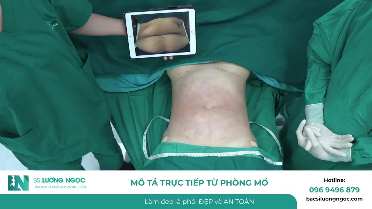 CHỊ KHÁCH TỪ FLORIDA BAY NỬA VÒNG TRÁI ĐẤT VÀ NHẬN LẠI KẾT QUẢ VÒNG BỤNG GIẢM GẦN 20CM