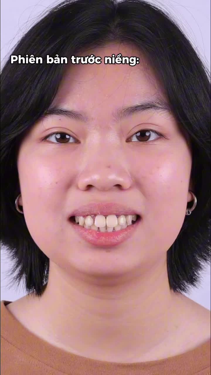 Một lần quyết tâm, cả đời rạng rỡ. Hãy để phiên bản tương lai cảm ơn quyết định dũng cảm của bạn ngày hôm nay