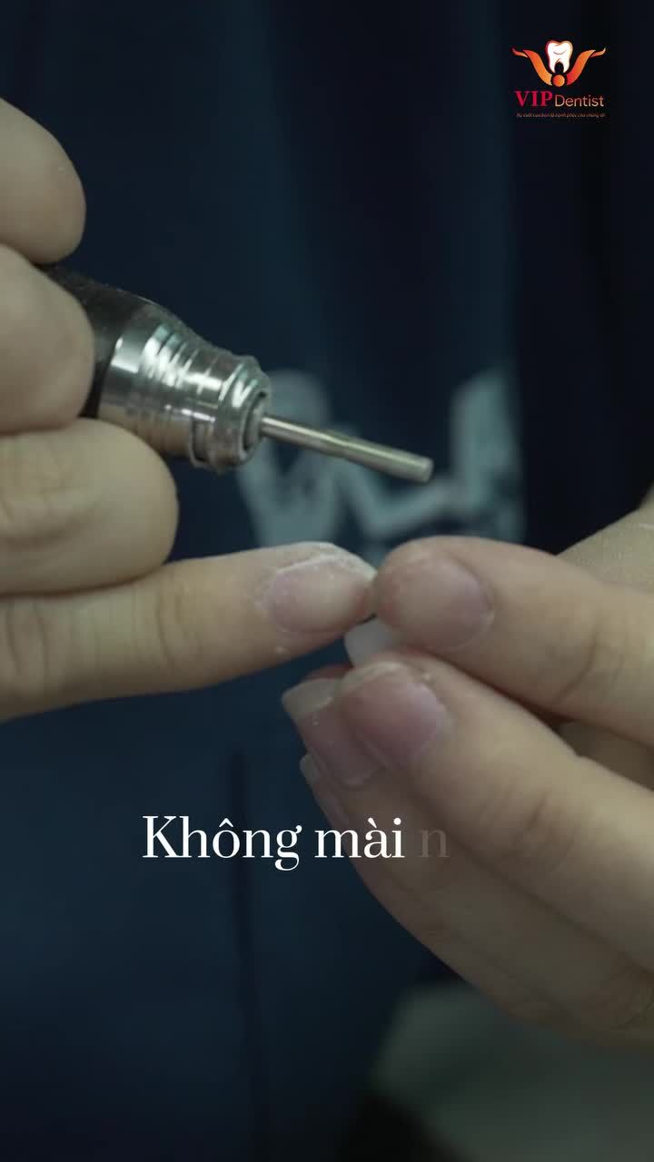 Nâng cấp nụ cười, nâng tầm khí chất cùng Dán sứ Veneer tại VIP Dentist. Tinh xảo trong từng milimet, tự nhiên như răng thật!