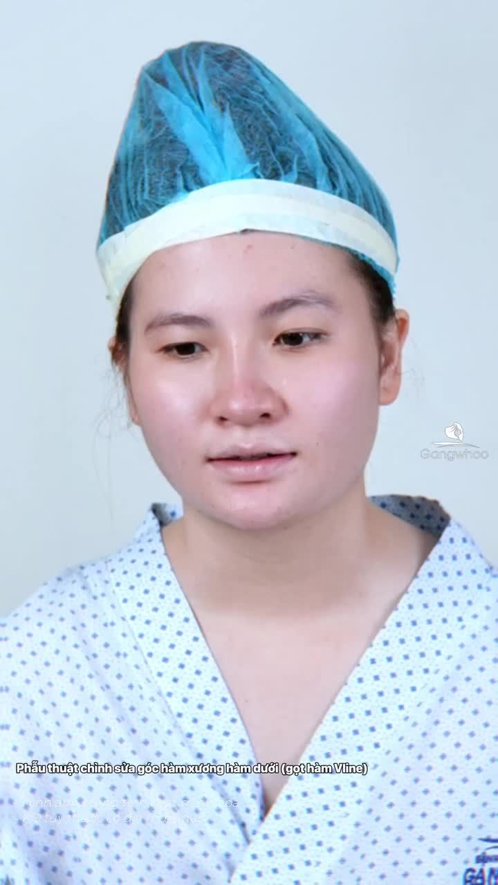 Hành trình sau 12 tiếng Gọt hàm V-line tại Gangwhoo sẽ như thế nào. Cùng xem kết quả và chia sẻ thực tế từ khách hàng.