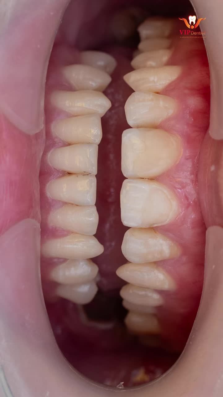 CHỈ MỘT THAY ĐỔI NHỎ - DIỆN MẠO CỦA THẢO ĐÃ "LÊN HƯƠNG" NGỠ NGÀNG!