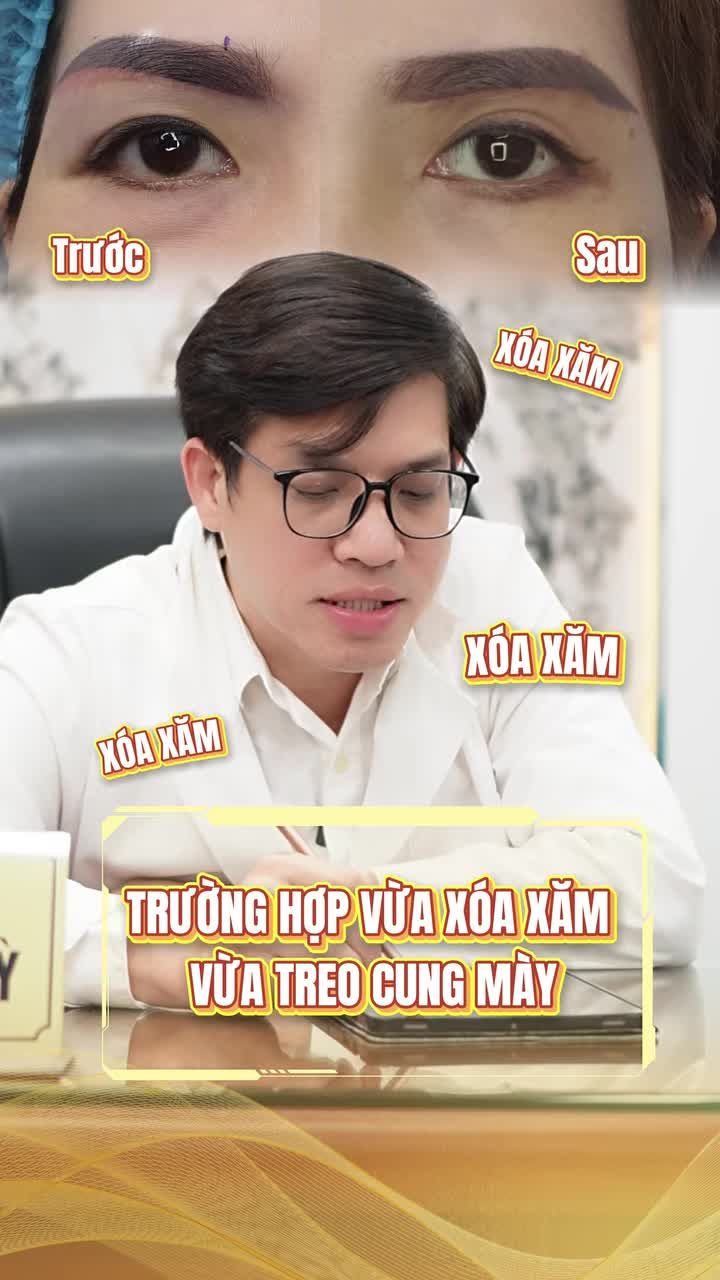 TẠM BIỆT CHÂN MÀY TRỔ MÀU DA CHÙNG – TRẺ RA 10 TUỔI