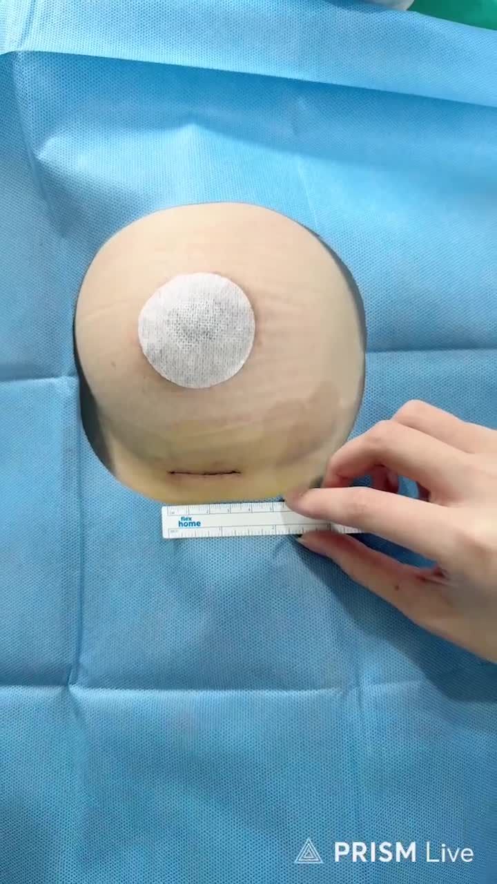 Sau phẫu thuật, điều gì giúp khách hàng phục hồi nhanh hơn?