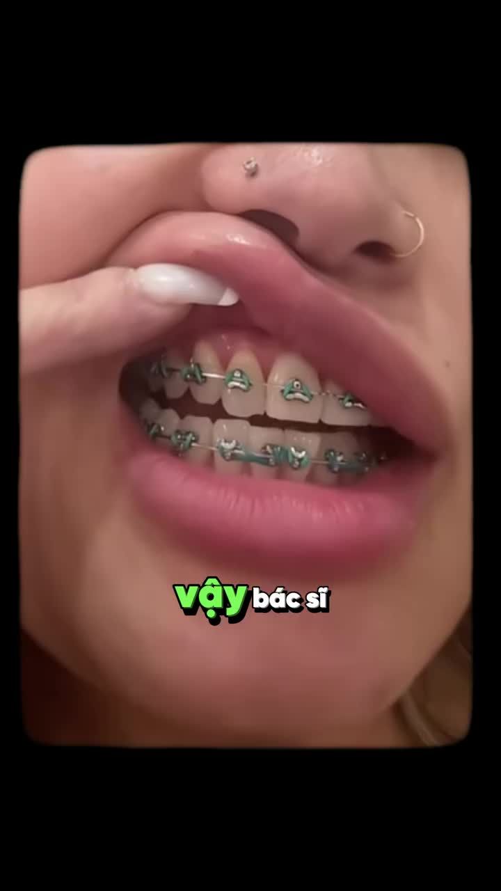 RĂNG LUNG LAY KHI NIỀNG CÓ SAO KHÔNG?