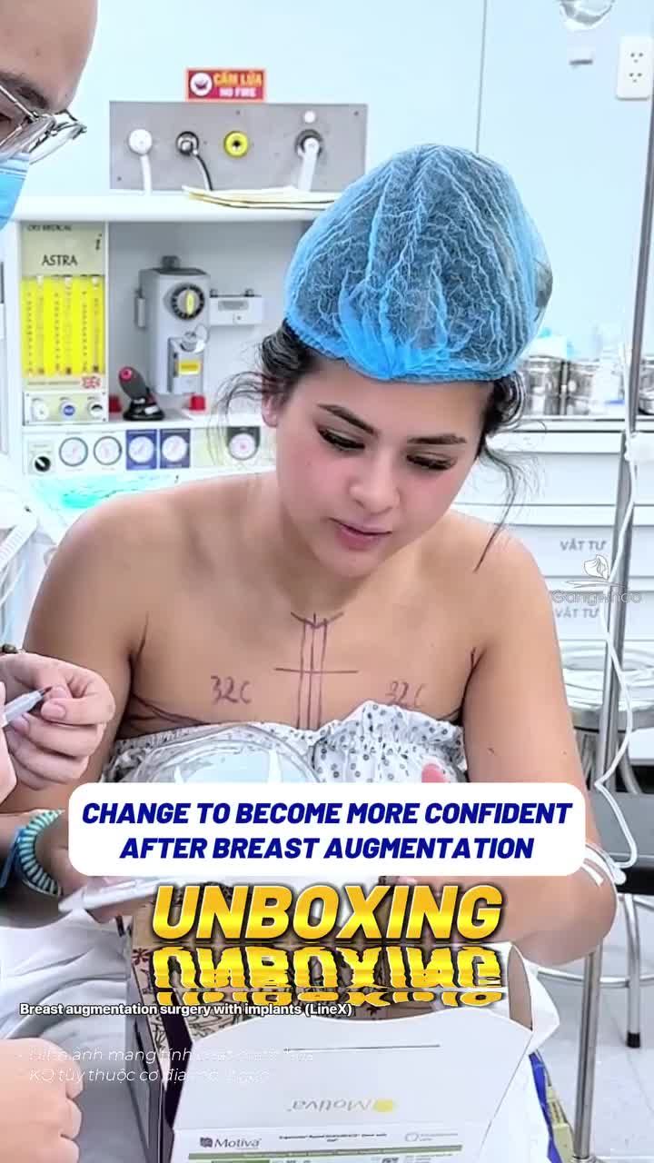 Thay đổi để tự tin hơn sau nâng ngực.  Khách hàng Australia trở lại Gangwhoo tái khám sau 2 tuần nâng cấp vòng 1, khiến ai cũng phải trầm trồ bởi diện mạo mới đầy quyến rũ cùng thần thái tự tin đến ngỡ ngàng