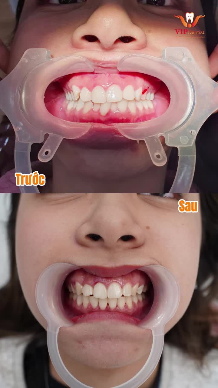 HÀNH TRÌNH CHẠM ĐẾN PHIÊN BẢN HOÀN HẢO NHẤT