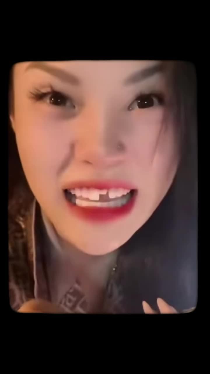 RĂNG SỨ RƠI RA SAU KHI BỌC?