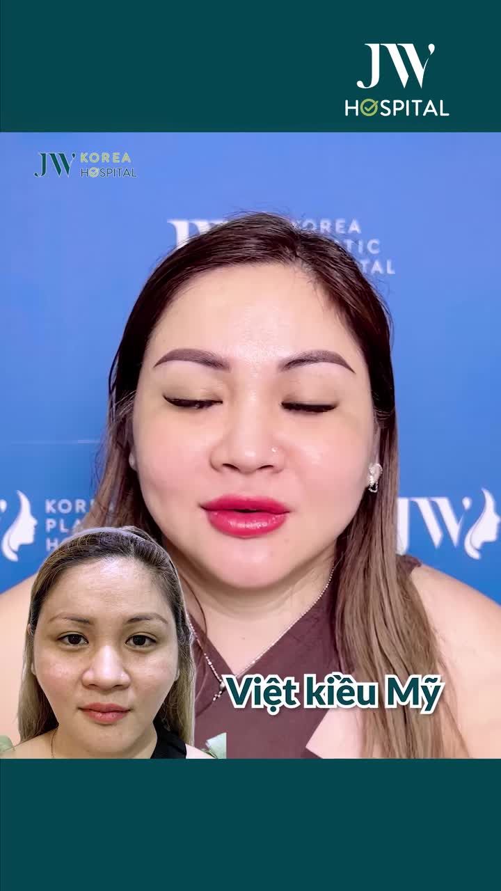 TRẺ 10 TUỔI CHO VIỆT KIỀU MỸ U40 SAU CẤY MỠ MẶT BABY FACE TRÒN TRỊA, HẾT HỐC HÁC
