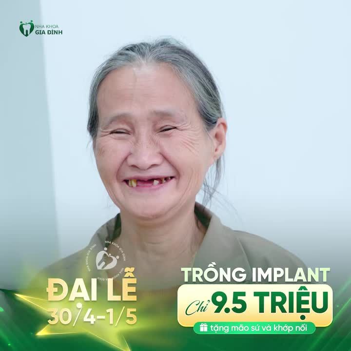 TRỒNG RĂNG IMPLANT - ƯU ĐÃI LỚN DỊP 30/4 - 1/5