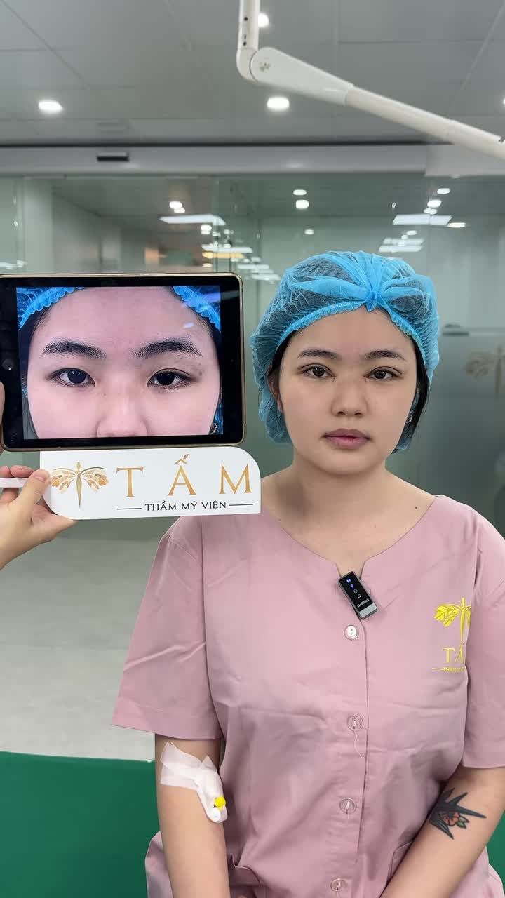Sau thời gian dài tìm hiểu kỹ lưỡng tại TMV Tấm, trước khi sang Séc định cư, cô gái đã quyết định “nâng cấp” diện mạo với combo: cắt mí Shanghai, mở góc trong và chuyển mỡ.