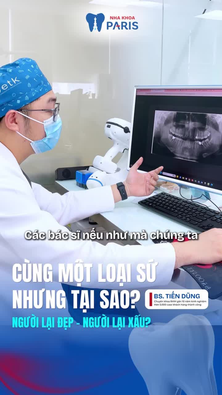 3 LÝ DO KHIẾN RĂNG SỨ TRÔNG "GIẢ TRÂN" – BẠN ĐÃ BIẾT?