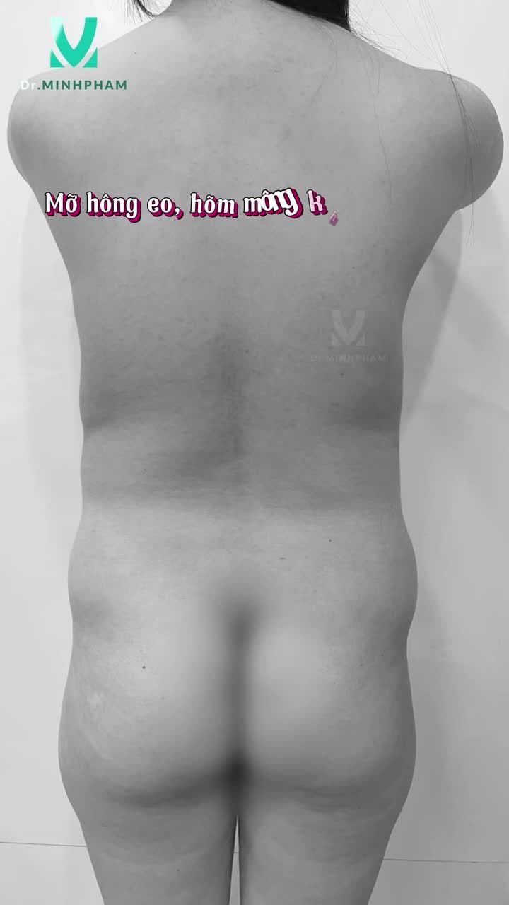 THOÁT RA KHỎI VÓC DÁNG NẶNG NỀ SUỐT MẤY MƯƠI NĂM