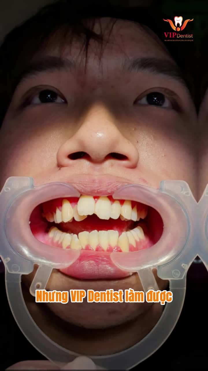 1 ĐIỀU MÀ CHẲNG AI LÀM ĐƯỢC - THÌ VIP DENTIST LÀM ĐƯỢC NHA!