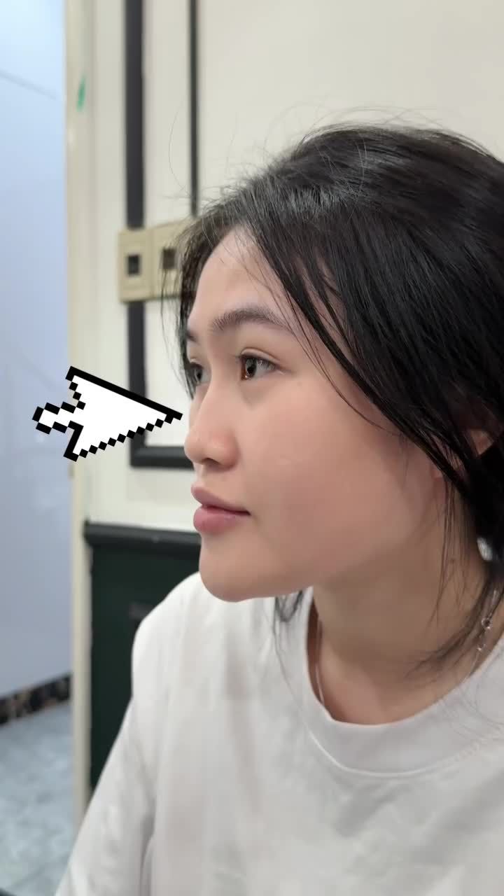 DÁNG MŨI KÉM THANH THOÁT ĐẸP SANG CHẢNH SAU 10 NGÀY!!
