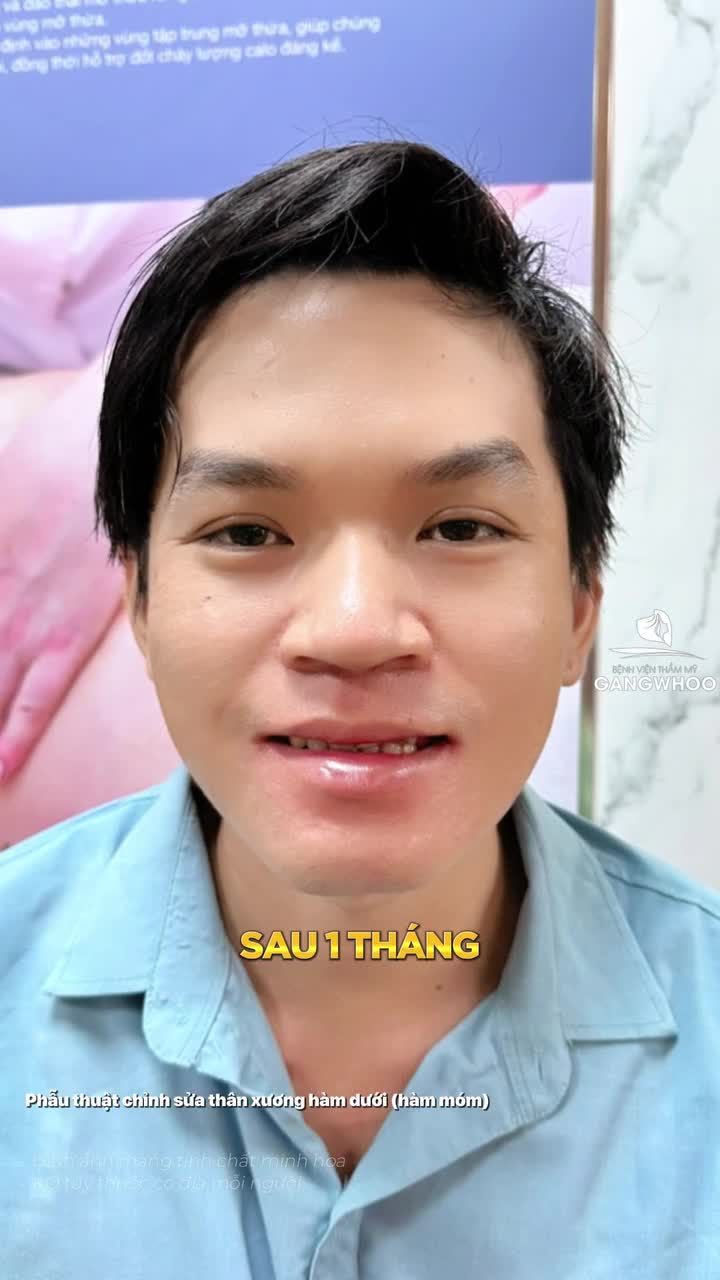 Chỉnh hình hàm móm, ứng dụng công nghệ nội soi 4K hiện đại.