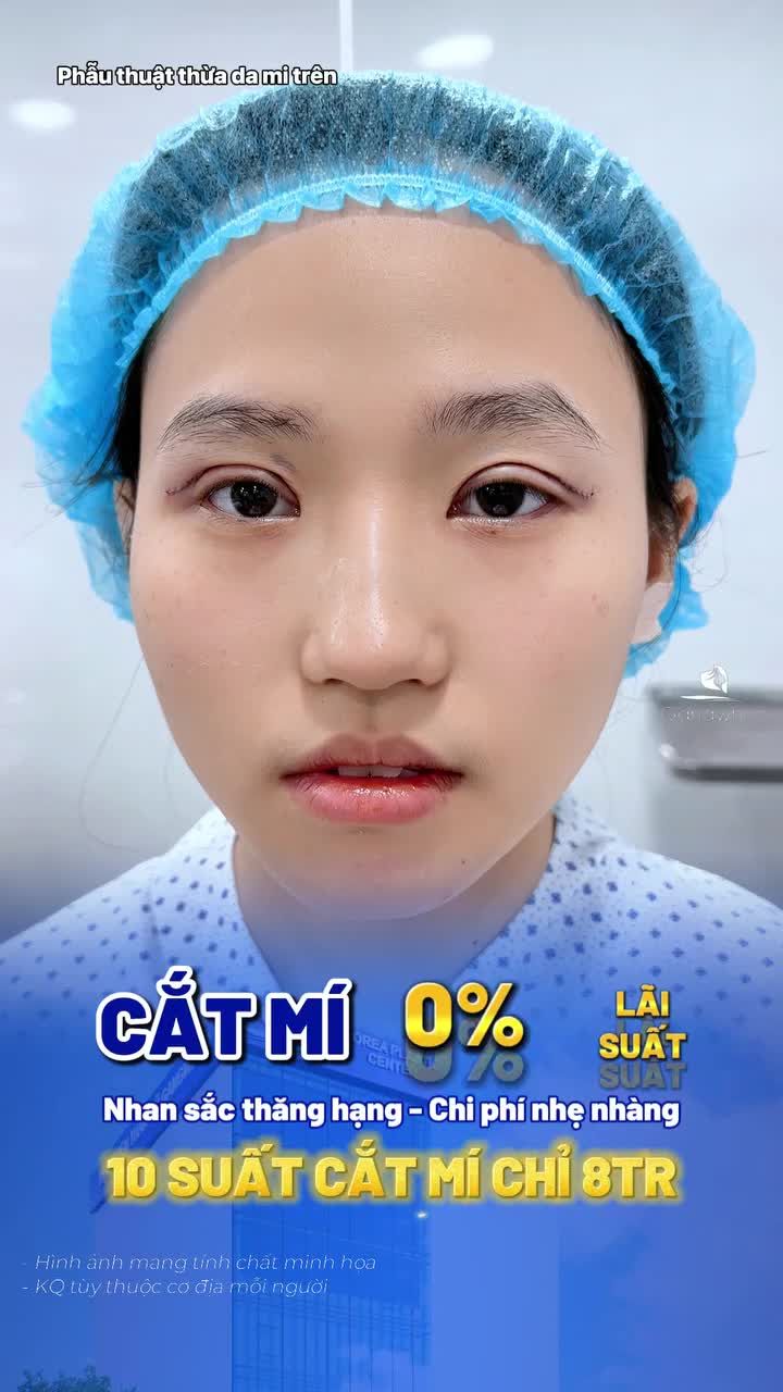 Sở hữu đôi mắt đẹp, an toàn và chuẩn y khoa với thời gian hồi phục nhanh chóng.