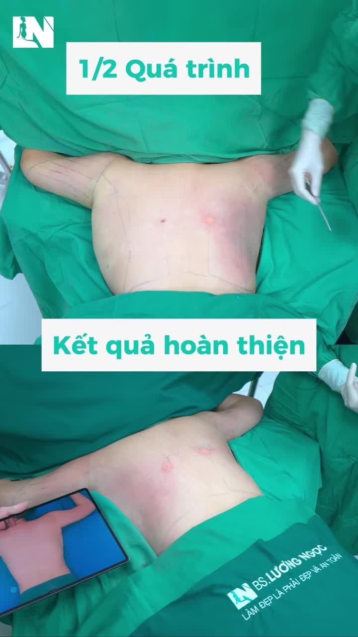 HÀNH TÌNH CẢI THIỆN VÙNG TAY , LƯNG CHO CHỊ KHÁCH