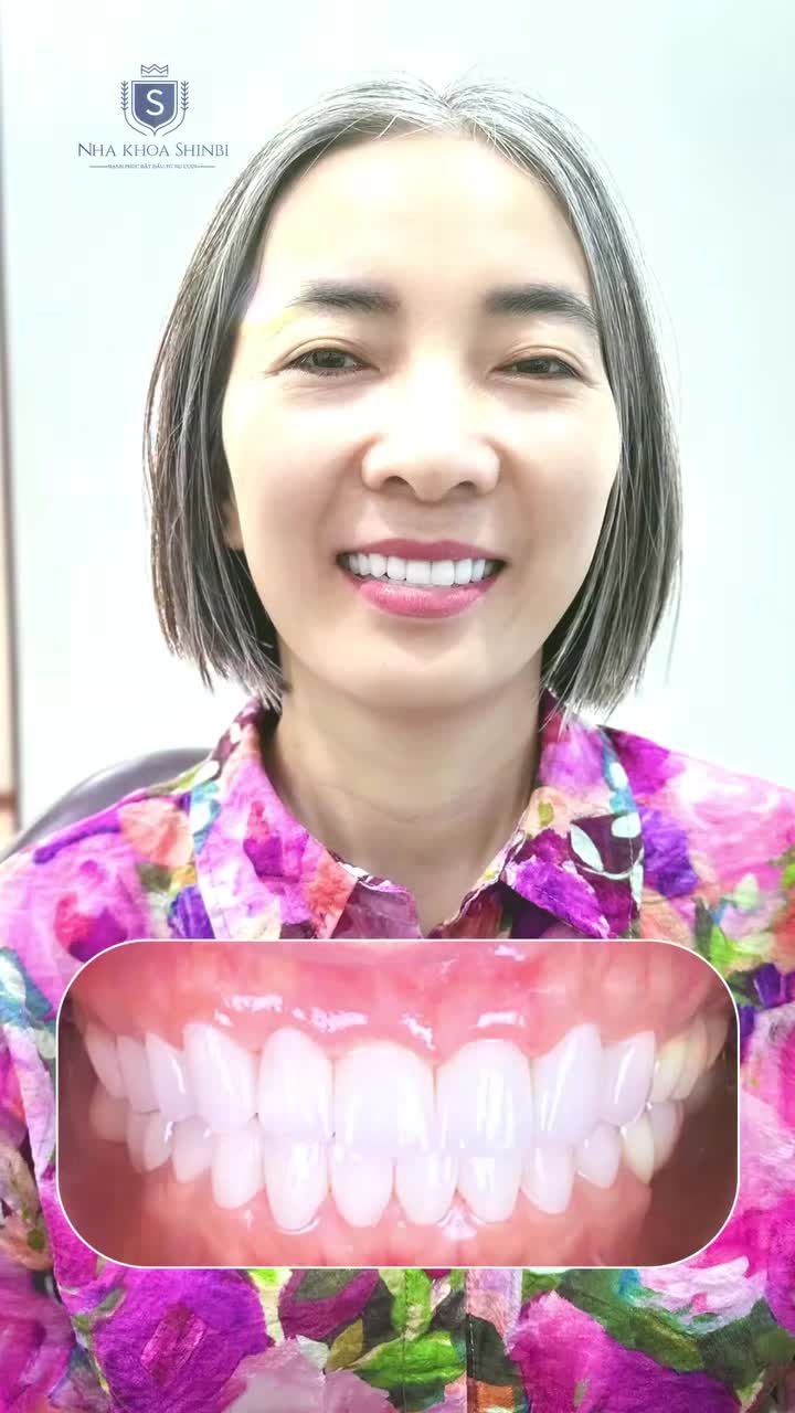 HẠNH PHÚC VỠ ÒA TÌM LẠI ĐƯỢC NỤ CƯỜI SAU NHIỀU NĂM CHỊU ĐỰNG HÀM RĂNG HỎNG
