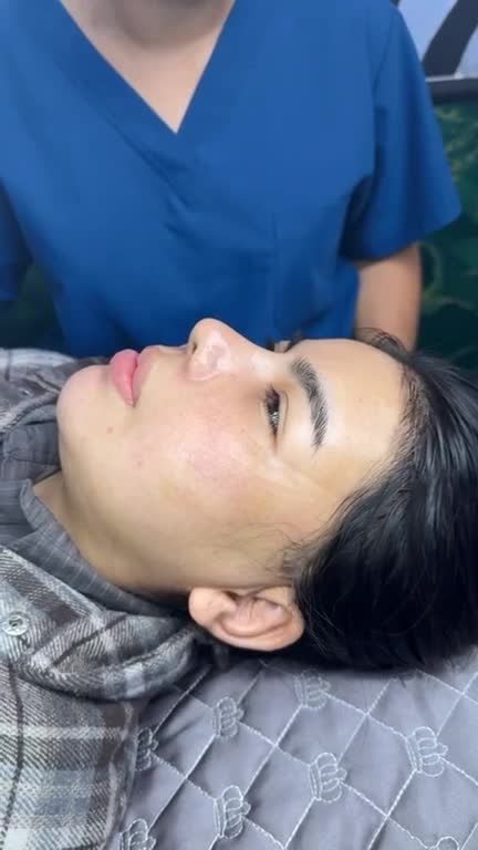 MŨI CẤU TRÚC SAU 1 THÁNG – DÁNG MŨI CÀNG NGẮM CÀNG MÊ