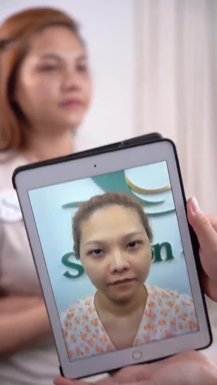 10 NGÀY NÂNG MŨI CẤU TRÚC DR. HOẠT