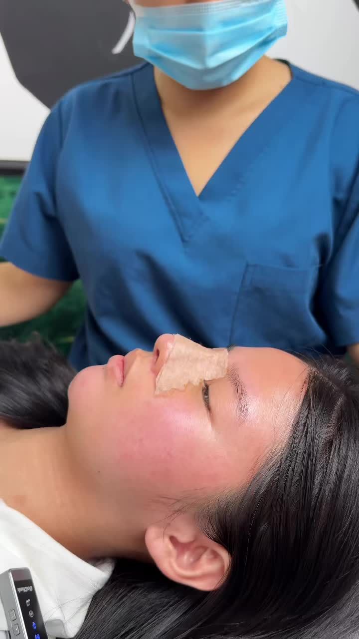 Case mũi cấu trúc được 10 ngày ạ