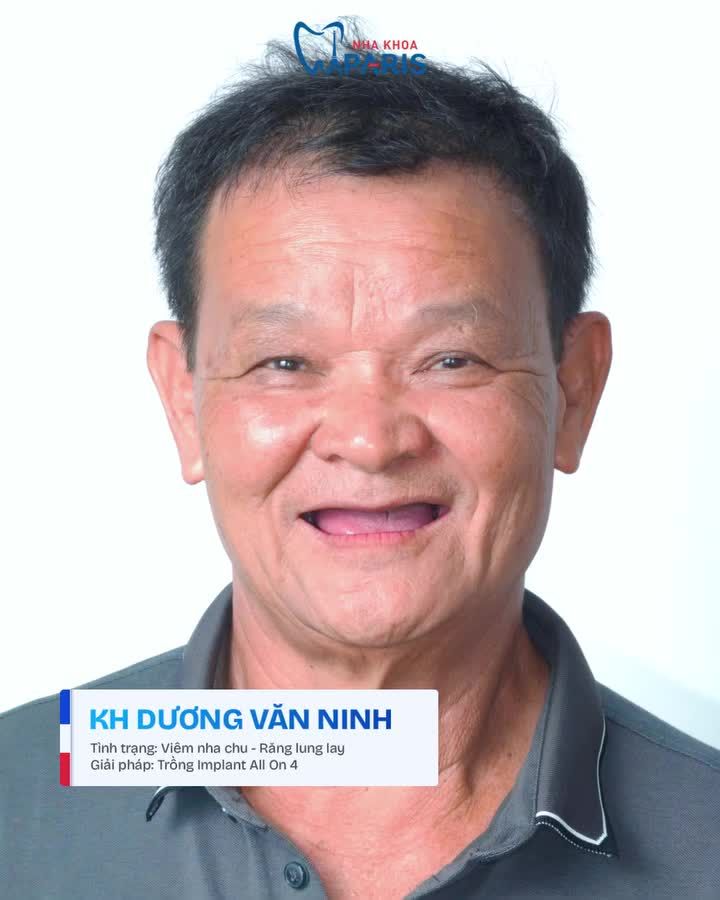 3 MÀN "TÁI SINH" NỤ CƯỜI TOÀN HÀM CHO CÁC BÁC MẤT RĂNG LÂU NĂM!