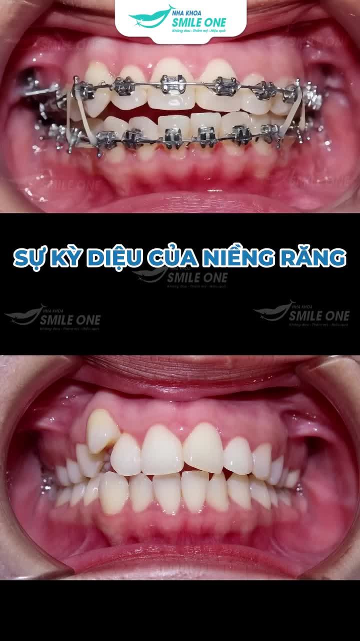 Bạn ƯỚC AO có một khuôn mặt cân đối nhưng LO NGẠI rủi ro?