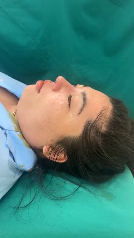 Mũi cấu trúc vừa hoàn thành