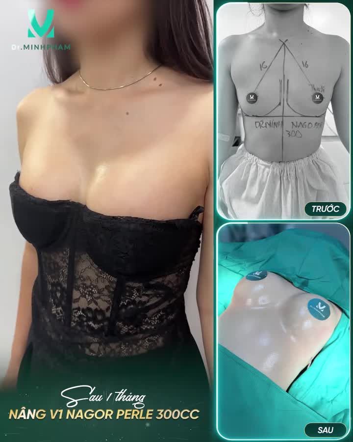 TỪNG NGẠI DIỆN ĐỒ BODY… NHƯNG GIỜ ĐÃ KHÁC